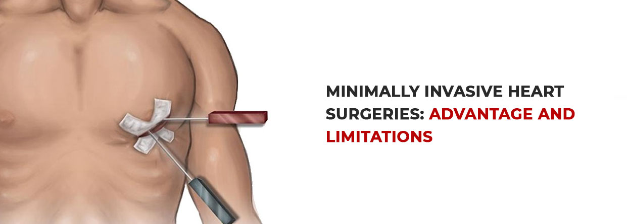 Minimally Invasive Heart Surgeries: Advantage and limitations